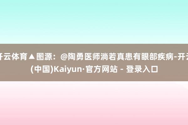开云体育▲图源：@陶勇医师淌若真患有眼部疾病-开云(中国)Kaiyun·官方网站 - 登录入口